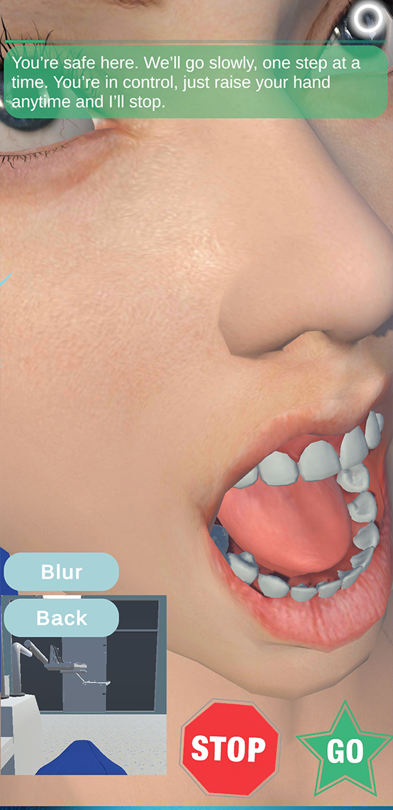 Maze Dental Calm — procedure walkthrough